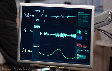 ECG Filter