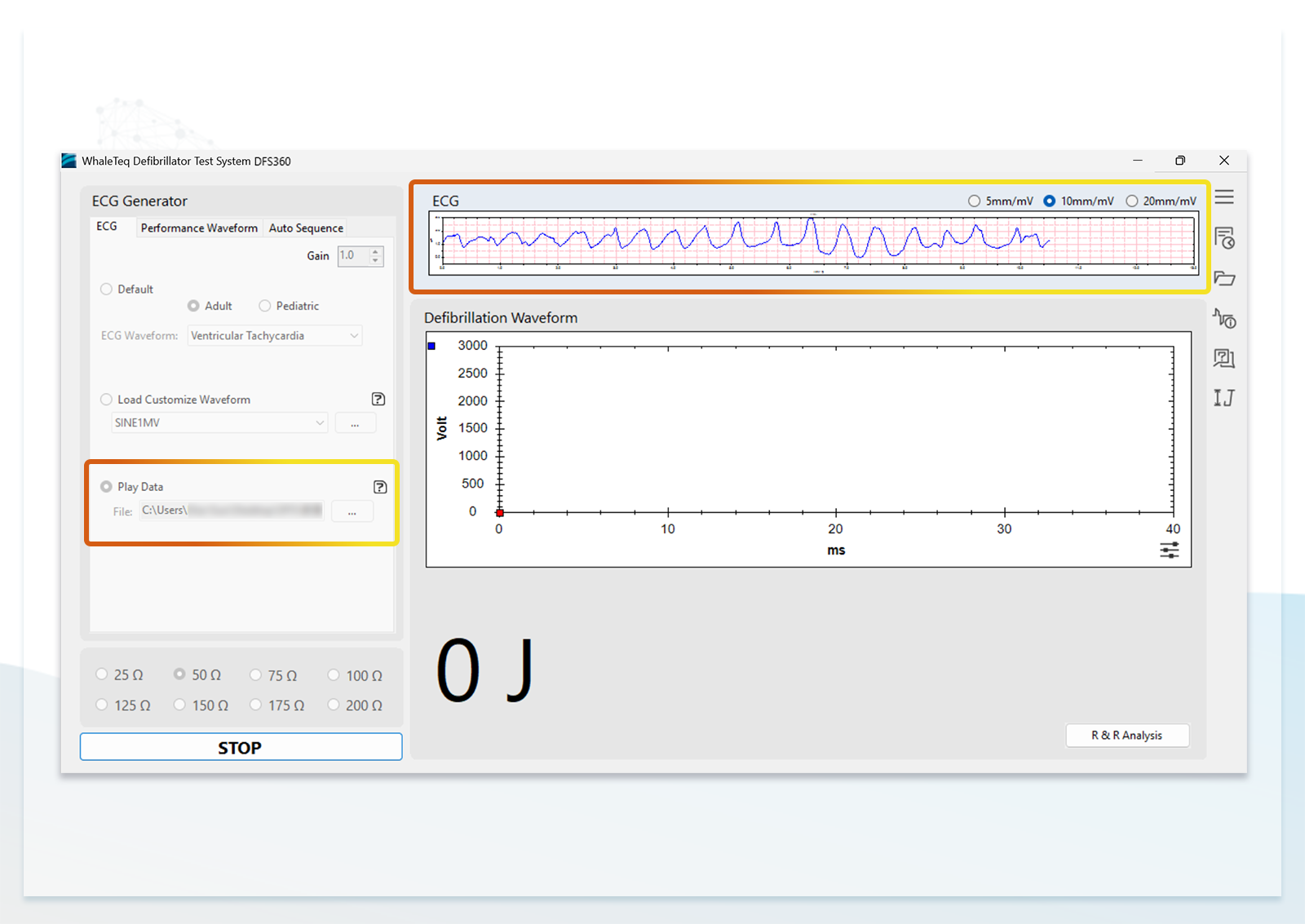 DFS360 Supports playback of ECG databases, and reproduces clinically recorded or user-defined waveforms for repeated verification to facilitate the development process.
